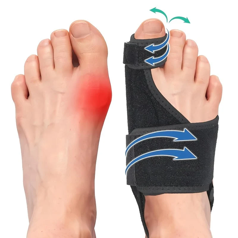 Skanto | Verstellbarer Hallux Valgus Korrektor