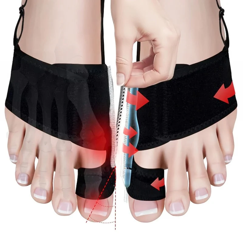 Skanto | Verstellbarer Hallux Valgus Korrektor