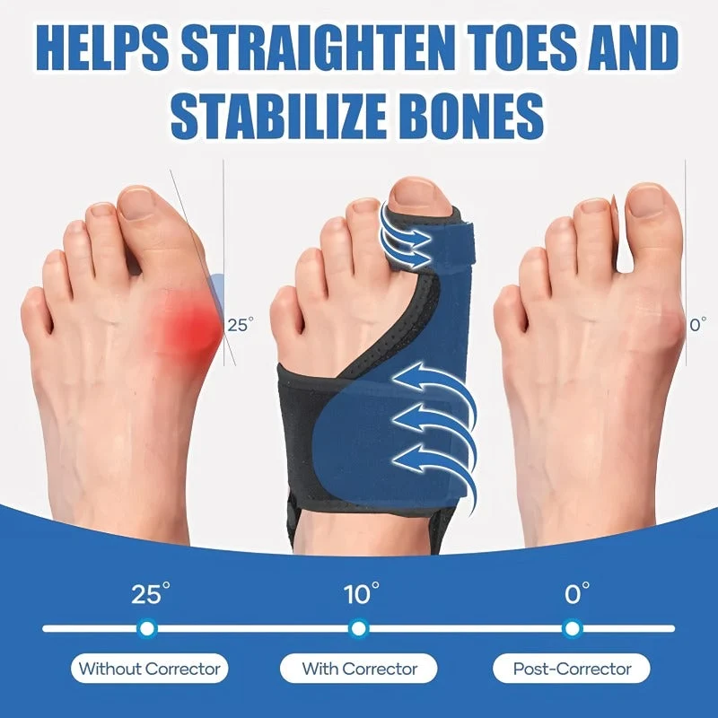 Skanto | Verstellbarer Hallux Valgus Korrektor