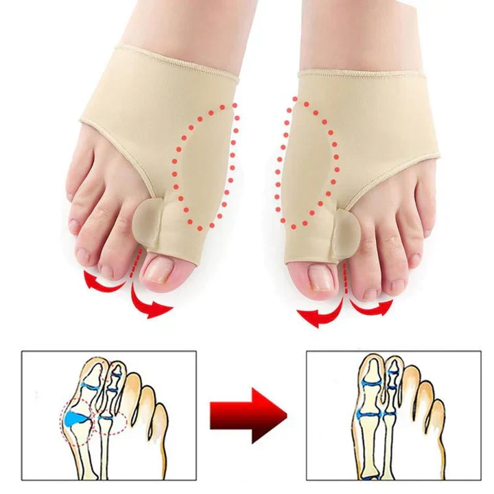 Hallux-Valgus-Korrektor & Zehentrenner aus weichem Silikon (1 Paar) für bequemen Alltag und sanfte Druckentlastung
